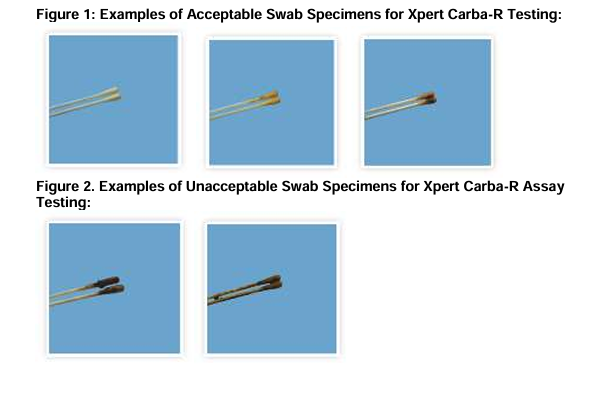 Example images of acceptably collected swabs, and unacceptably collected swabs